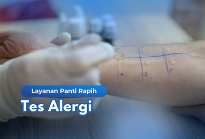 Tes Alergi RS Panti Rapih